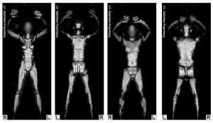 Millimeter-wave image